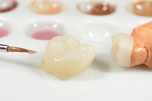 Dental crowns being crafted